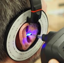 3D-scanning av öron Pris/person